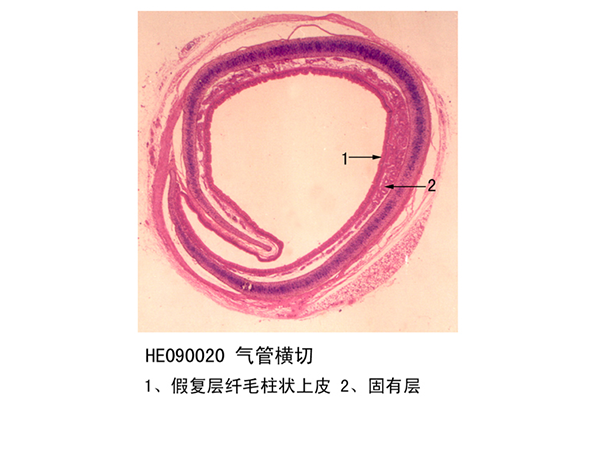 ?氣管橫切