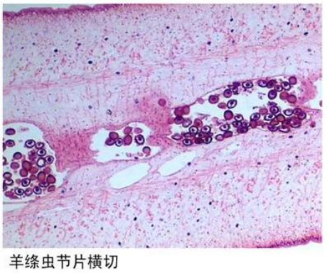 鶴崗羊絳蟲節片橫切