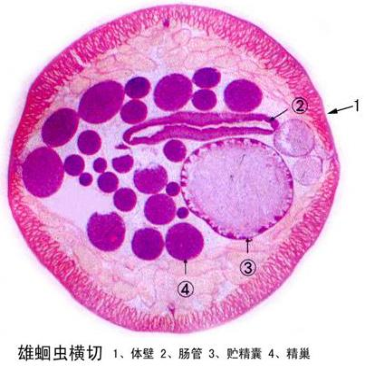 吐魯番雄蛔蟲橫切