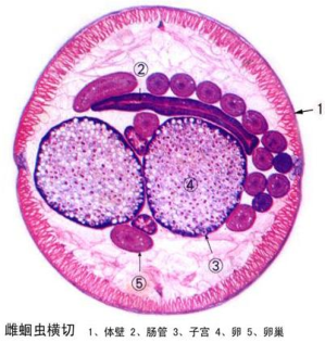 吐魯番雌蛔蟲橫切