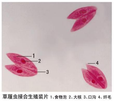 草履蟲接合生殖裝片