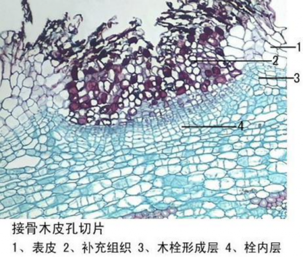 寧夏接骨木皮孔切片