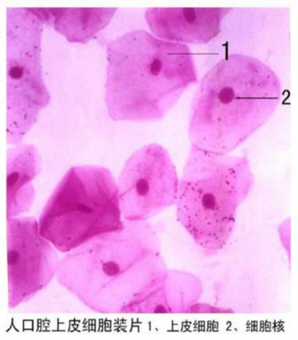 儋州人口腔上皮細胞裝片