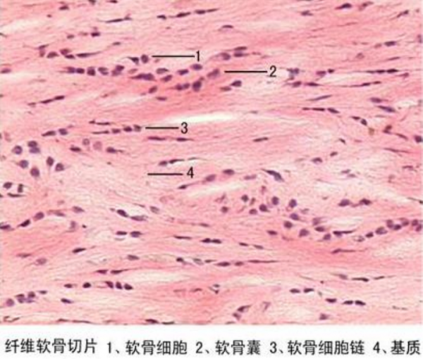 麗水纖維軟骨切片