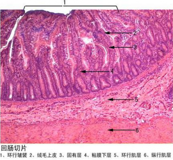 三門峽回腸切片