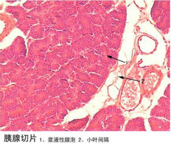 麗水胰腺切片