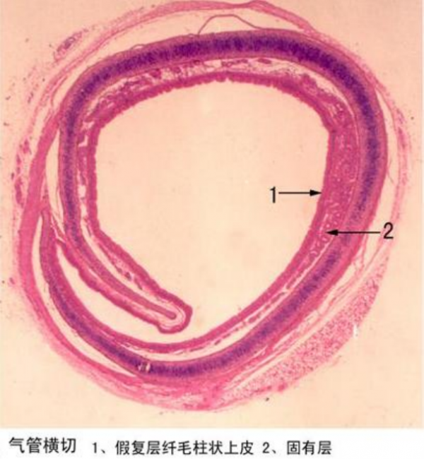 孝感氣管橫切