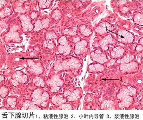 宜賓舌下腺切片