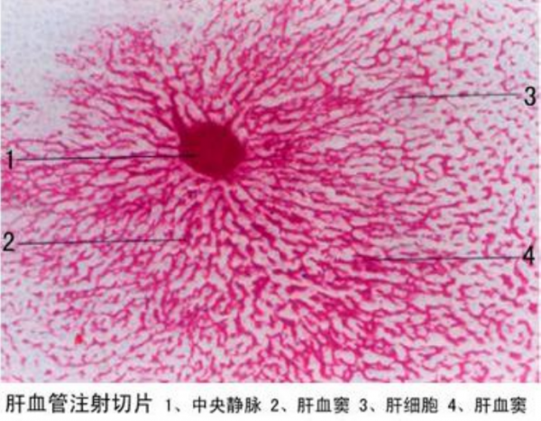 五家渠肝血管注射切片