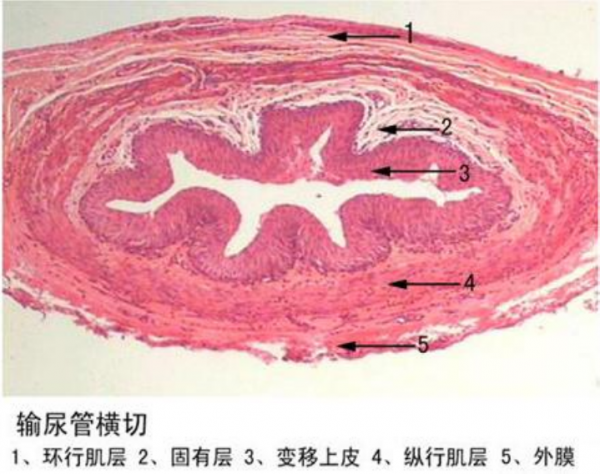 西雙版納輸尿管橫切