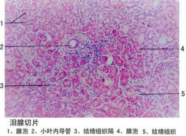 江蘇淚腺切片