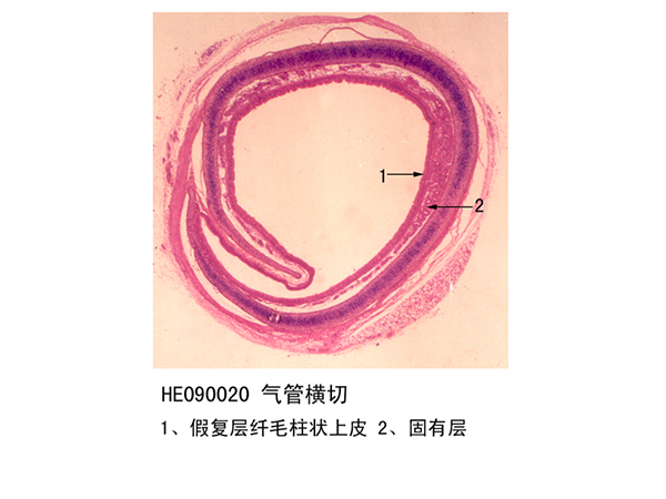 氣管橫切