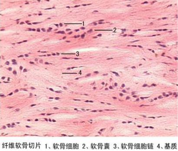 纖維軟骨切片