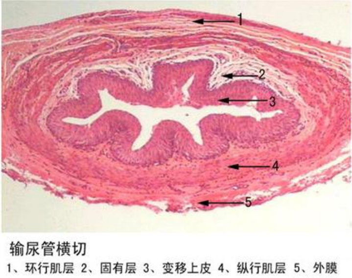 輸尿管橫切