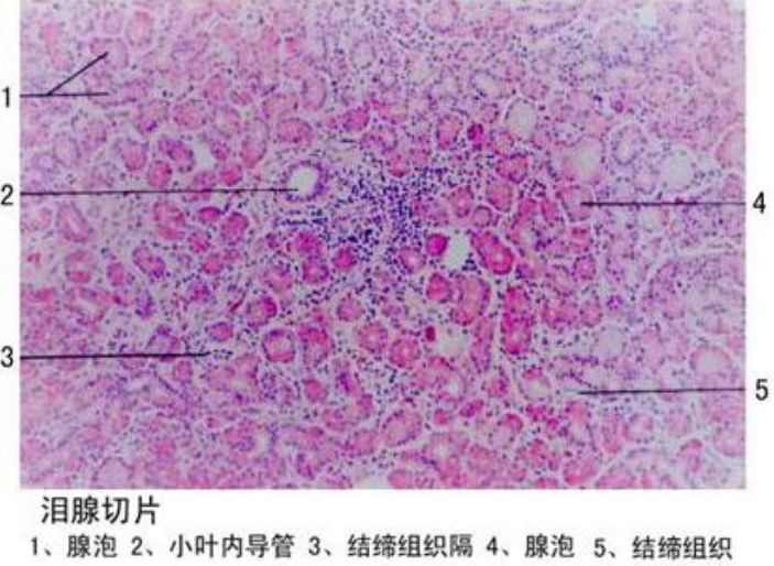 淚腺切片